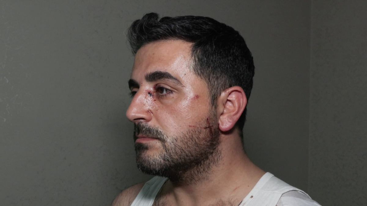 esenyurtta kiraci dehseti ev sahibini bicakladi DebTjWL8.jpg